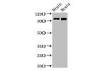 Western Blot<br />
Positive WB detected in:Rat brain tissue,Mouse brain tissue<br />
All lanes:ATP6V0A1 antibody at 3