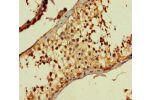 Immunohistochemistry of paraffin-embedded human testis tissue using CSB-PA846572LA01HU at dilution of 1:100