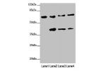 Western blot<br />
All lanes