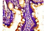 Immunohistochemistry of paraffin-embedded human small intestine tissue using CSB-PA846585LA01HU at dilution of 1:100