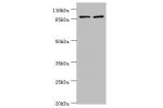 Western blot<br />
All lanes:GCC1 antibody at 2ug/ml<br />
Lane 1:Hela cells<br />
Lane 2:293T cells<br />
Secondary<br />
Goat polyclonal to rabbit at 1/10000 dilution<br />
Predicted band size: 88kDa<br />
Observed band size: 88kDa<br />