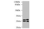 Western blot<br />
All lanes: CMBL antibody at 1ug/ml<br />
Lane 1 : Mouse kidney tissue<br />
Lane 2 : Mouse liver tissue<br />
Secondary<br />
Goat polyclonal to Rabbit IgG at 1/10000 dilution<br />
Predicted band size: 28 kDa<br />
Observed band size: 