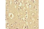 Immunohistochemistry of paraffin-embedded human brain tissue using CSB-PA846633LA01HU at dilution of 1:100