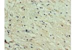 Immunohistochemistry of paraffin-embedded human brain tissue using CSB-PA846659HA01HU at dilution 1:100