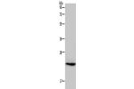 Gel: 10%SDS-PAGE, Lysate: 40 