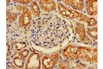 Immunohistochemistry of paraffin-embedded human kidney tissue using CSB-PA847226LA01HU at dilution of 1:100