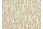 Immunohistochemistry of paraffin-embedded human adrenal gland tissue using CSB-PA847606LA01HU at dilution of 1:100