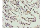 Immunohistochemistry of paraffin-embedded human lung tissue using CSB-PA848394LA01HU at dilution of 1:100