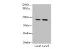 Western blot<br />
All lanes: FBXO25 antibody at 3ug/ml<br />
Lane 1 : Mouse liver tissue<br />
Lane 2 : Mouse kidney tissue<br />
Secondary<br />
Goat polyclonal to Rabbit IgG at 1/10000 dilution<br />
Predicted band size: 44,43,35 kDa<br />
Observed ban