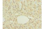 Immunohistochemistry of paraffin-embedded human adrenal gland tissue using CSB-PA848813LA01HU at dilution of 1:100