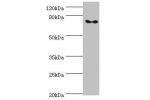 Western blot<br />
All lanes:ATRIP antibody at 2ug/ml<br />
Lane 1:MCF-7 whole cell lysate<br />
Lane 2:A549 whole cell lysate<br />
Lane 3:PC-3 whole cell lysate<br />
Secondary<br />
Goat polyclonal to rabbit at 1/10000 dilution<br />
Predicted band siz