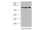 Western blot<br />
All lanes:CTNNBL1 antibody at 5.39ug/ml<br />
Lane 1:Hela whole cell lysate<br />
Lane 2:jurkat whole cell lysate<br />
Lane 3:293T whole cell lysate<br />
Secondary<br />
Goat polyclonal to rabbit at 1/10000 dilution<br />
Predicted ba