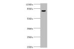 Western blot<br />
All lanes:Protein BANP antibody at 8ug/ml+Hela whole cell lysate<br />
Secondary<br />
Goat polyclonal to rabbit at 1/10000 dilution<br />
Predicted band size: 80kDa<br />
Observed band size: 80kDa<br />