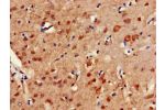 Immunohistochemistry of paraffin-embedded human brain tissue using CSB-PA849795HA01HU at dilution of 1:100