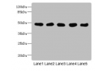 Western Blot<br />
All lanes: GCDH antibody at 8ug/ml<br />
Lane 1 : Mouse kidney tissue<br />
Lane 2 : Mouse liver tissue<br />
Lane 3 : Hela whole cell lysate<br />
Lane 4 : MCF7 whole cell lysate<br />
Lane 5 : LO2 whole cell lysate<br />
Secondary<br 