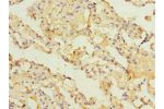 Immunohistochemistry of paraffin-embedded human lung tissue using CSB-PA850249LA01HU at dilution of 1:100
