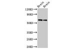 Western Blot<br />
Positive WB detected in:Rat brain tissue,Mouse brain tissue<br />
All lanes:CPNE4 antibody at 2