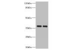Western blot<br />
All lanes:Aldose 1-epimerase antibody at 2ug/ml<br />
Lane 1:mouse kidney tissue<br />
Lane 2:rat adrenal gland tissue<br />
Secondary<br />
Goat polyclonal to rabbit at 1/10000 dilution<br />
Predicted band size: 38kDa<br />
Observed b