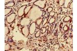 Immunohistochemistry of paraffin-embedded human thyroid tissue using CSB-PA850269LA01HU at dilution of 1:100