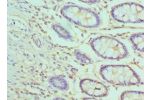 Immunohistochemistry of paraffin-embedded human rectum using CSB-PA850274ESR1HU at dilution 1:100