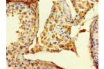 Immunohistochemistry of paraffin-embedded human testis tissue using CSB-PA850291LA01HU at dilution of 1:100