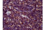 IHC image of CSB-PA850301LA01HU diluted at 1:400 and staining in paraffin-embedded human lymph node tissue performed on a Leica BondTM system. After dewaxing and hydration, antigen retrieval was mediated by high pressure in a citrate buffer (pH 6.0). Sect