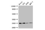 Western Blot<br />
Positive WB detected in:Mouse brain tissue,PC3 whole cell lysate,A549 whole cell lysate,MCF-7 whole cell lysate<br />
All lanes : APOPT1 antibody at 2.7
