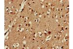 Immunohistochemistry of paraffin-embedded human brain tissue using CSB-PA850384LA01HU at dilution of 1:100