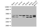 Western Blot<br />
Positive WB detected in:Mouse heart tissue,Mouse liver tissue,Mouse spleen tissue,Mouse lung tissue,Mouse kidney tissue,Mouse brain tissue,Mouse skeletal muscle tissue<br />
All lanes: DGAT2 antibody at 3ug/ml<br />
Secondary<br />
Goat
