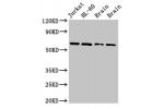Western Blot<br />
Positive WB detected in:Jurkat whole cell lysate,HL-60 whole cell lysate,Rat brain tissue,Mouse brain tissue<br />
All lanes:ARX antibody at 2.7