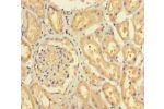 Immunohistochemistry of paraffin-embedded human kidney tissue using CSB-PA850424LA01HU at dilution of 1:100