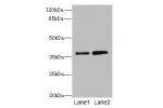 Western blot<br />
All lanes: CLYBL antibody at 1ug/ml<br />
Lane 1 : Hela whole cell lysate<br />
Lane 2 : NIH/3T3 whole cell lysate<br />
Secondary<br />
Goat polyclonal to Rabbit IgG at 1/10000 dilution<br />
Predicted band size: 38,34 kDa<br />
Observ