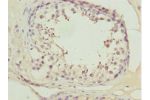 Immunohistochemistry of paraffin-embedded human testis tissue using CSB-PA850773ESR1HU at dilution 1:100