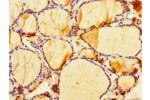 Immunohistochemistry of paraffin-embedded human thyroid tissue using CSB-PA850790LA01HU at dilution of 1:100