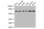 Western Blot<br />
Positive WB detected in:Hela whole cell lysate,NIH/3T3 whole cell lysate,A549 whole cell lysate,Rat lung tissue,Rat kidney tissue,Mouse heart tissue<br />
All lanes:ARHGAP18 antibody at 4.5
