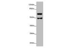 Western blot<br />
All lanes: GALNT16 antibody at 12 ug/ml+Mouse kidney tissue<br />
 Goat polyclonal to rabbit at 1/10000 dilution<br />
Predicted band size: 64,61 kDa<br />
Observed band size: 63,49 kDa<br />