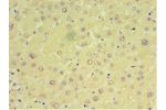 Immunohistochemistry of paraffin-embedded human liver tissue using CSB-PA850802HA01HU at dilution 1:100