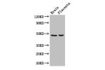 Western Blot<br />
Positive WB detected in:Mouse brain tissue,Human placenta tissue<br />
All lanes: CD177 antibody at 3ug/ml<br />
Secondary<br />
Goat polyclonal to rabbit IgG at 1/50000 dilution<br />
Predicted band size: 47,28,16 kDa<br />
Observed ba
