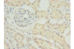 Immunohistochemistry of paraffin-embedded human kidney tissue using CSB-PA850823LA01HU at dilution of 1:100