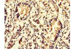 Immunohistochemistry of paraffin-embedded human appendix tissue using CSB-PA850845LA01HU at dilution of 1:100