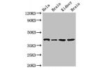Western Blot<br />
Positive WB detected in:Hela whole cell lysate,Rat brain tissue,Mouse kidney tissue,Mouse brain tissue<br />
All lanes:ATAD1 antibody at 4