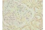 Immunohistochemistry of paraffin-embedded human kidney tissue using CSB-PA850873LA01HU at dilution of 1:100