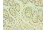 Immunohistochemistry of paraffin-embedded human rectum using CSB-PA850918ESR1HU at dilution 1:100