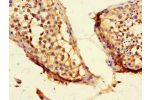 Immunohistochemistry of paraffin-embedded human testicular tissue using CSB-PA851560LA01HU at dilution of 1:100