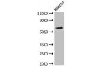 Western Blot<br />
Positive WB detected in:HEK293 whole cell lysate<br />
All lanes:DEPDC1B antibody at 4