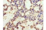 Immunohistochemistry of paraffin-embedded CSB-PA852913DA01HU using human lung tissue at dilution 1:100