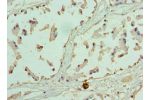 Immunohistochemistry of paraffin-embedded human prostate using CSB-PA852913DSR1HU at dilution 1:100