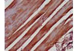 IHC image of CSB-PA853382LA01HU diluted at 1:500 and staining in paraffin-embedded human skeletal muscle tissue performed on a Leica BondTM system. After dewaxing and hydration, antigen retrieval was mediated by high pressure in a citrate buffer (pH 6.0).