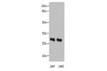 Western blot<br />
All lanes: EXOSC8 antibody at 4ug/ml<br />
Lane 1 : Mouse heart tissue<br />
Lane 2 : Hela whole cell lysate<br />
 Goat polyclonal to Rabbit IgG at 1/10000 dilution<br />
Predicted band size: 30 kDa<br />
Observed band size: 30 kDa<br 