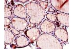 Immunohistochemistry of paraffin-embedded human thyroid tissue using CSB-PA853397LA01HU at dilution of 1:100